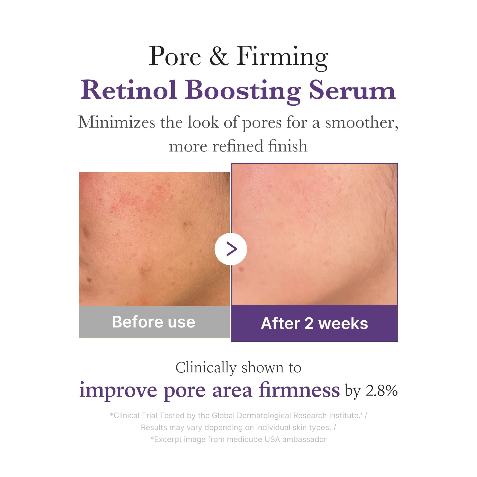 Medicube Retinol NMN Boosting Korean Face Serum 30ml