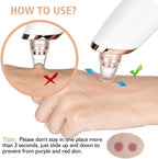5-in-1 Electric Blackhead Remover Vacuum with LCD Screen