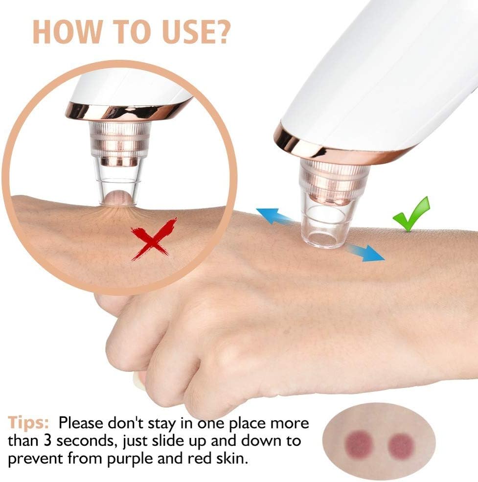 5-in-1 Electric Blackhead Remover Vacuum with LCD Screen