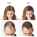 DeXe Hair Building Fibers Black 22g – Instant Hair Thickening Fiber Powder for Men & Women | Natural Hair Loss Concealer for Thinning Hair | Long-Lasting Full Coverage