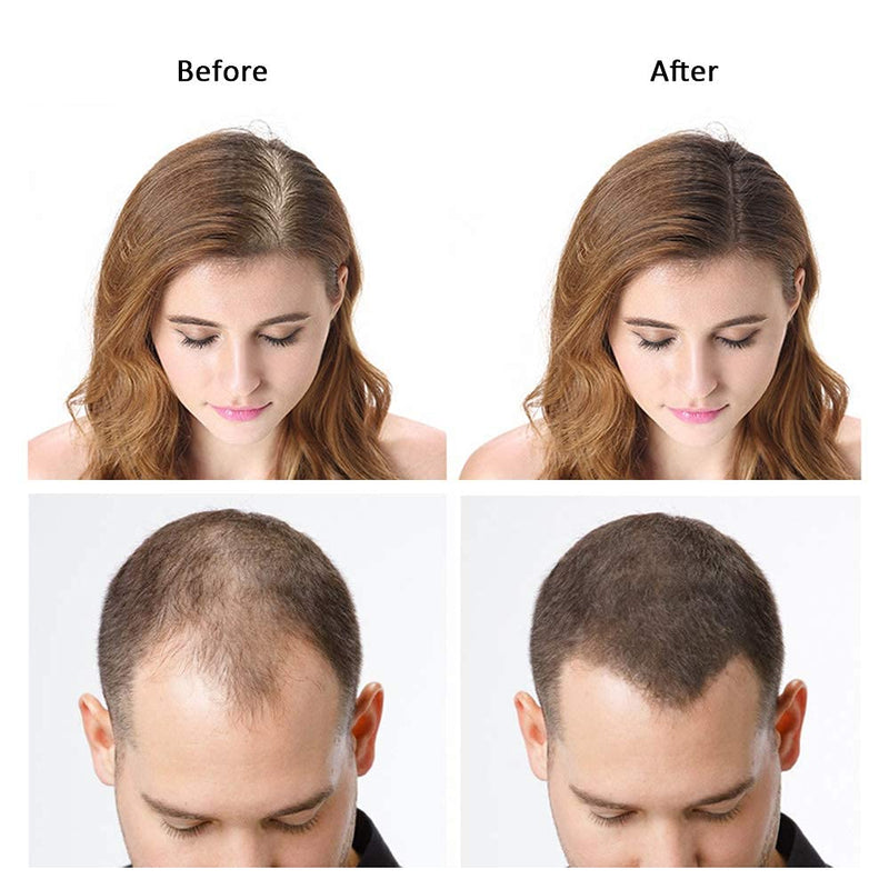 DeXe Hair Building Fibers Black 22g – Instant Hair Thickening Fiber Powder for Men & Women | Natural Hair Loss Concealer for Thinning Hair | Long-Lasting Full Coverage