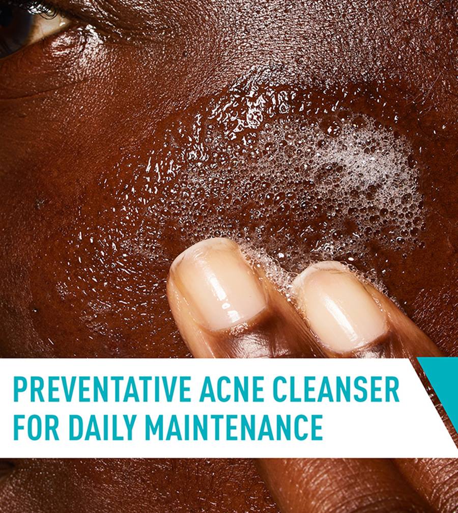 CeraVe Acne Control Cleanser 237 ml