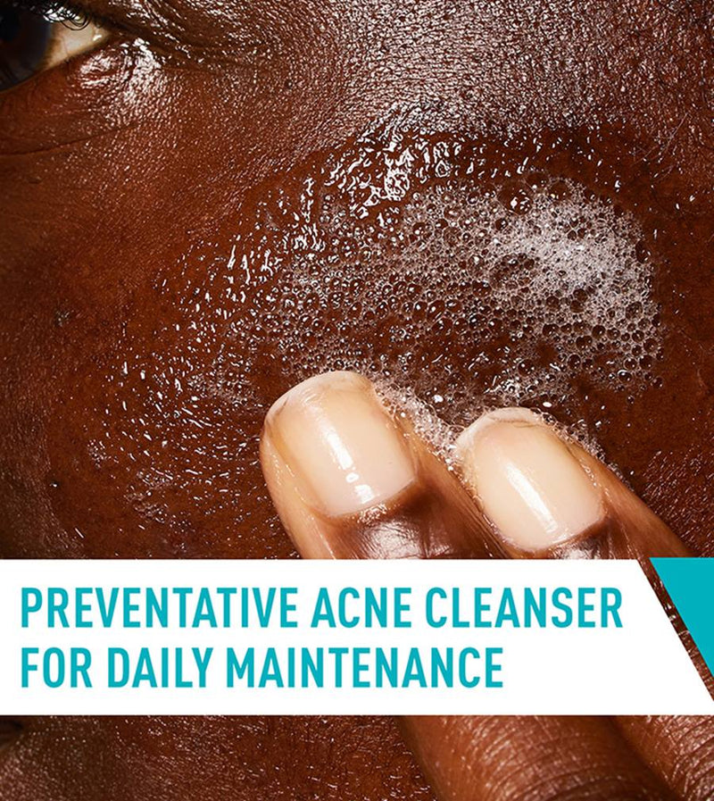 CeraVe Acne Control Cleanser 237 ml