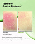 Anua Azelaic Acid 10 Hyaluron Redness Soothing Serum