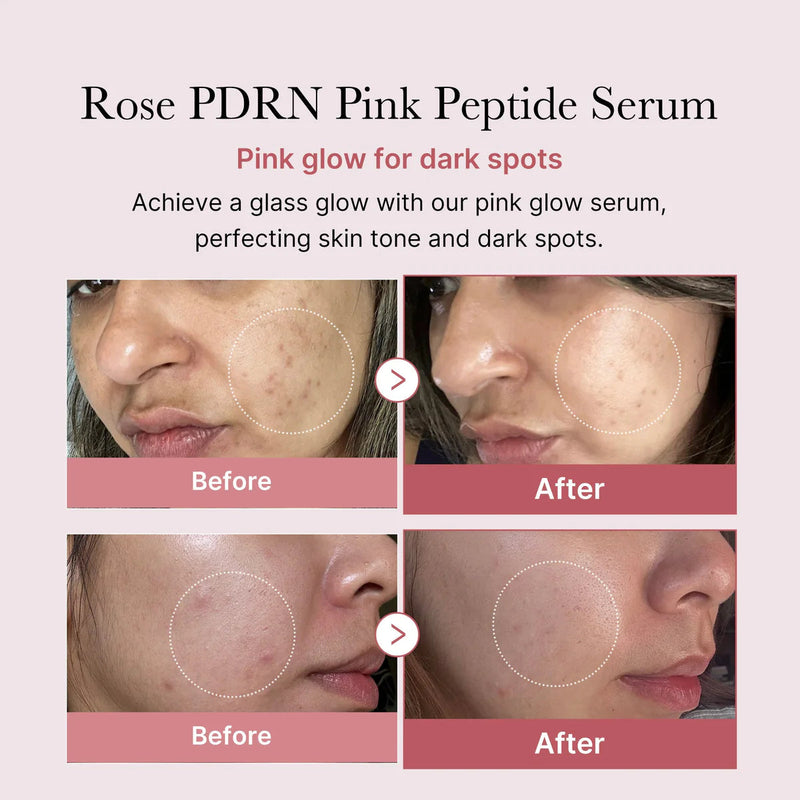 Medicube – PDRN Pink Peptide Serum 30ml