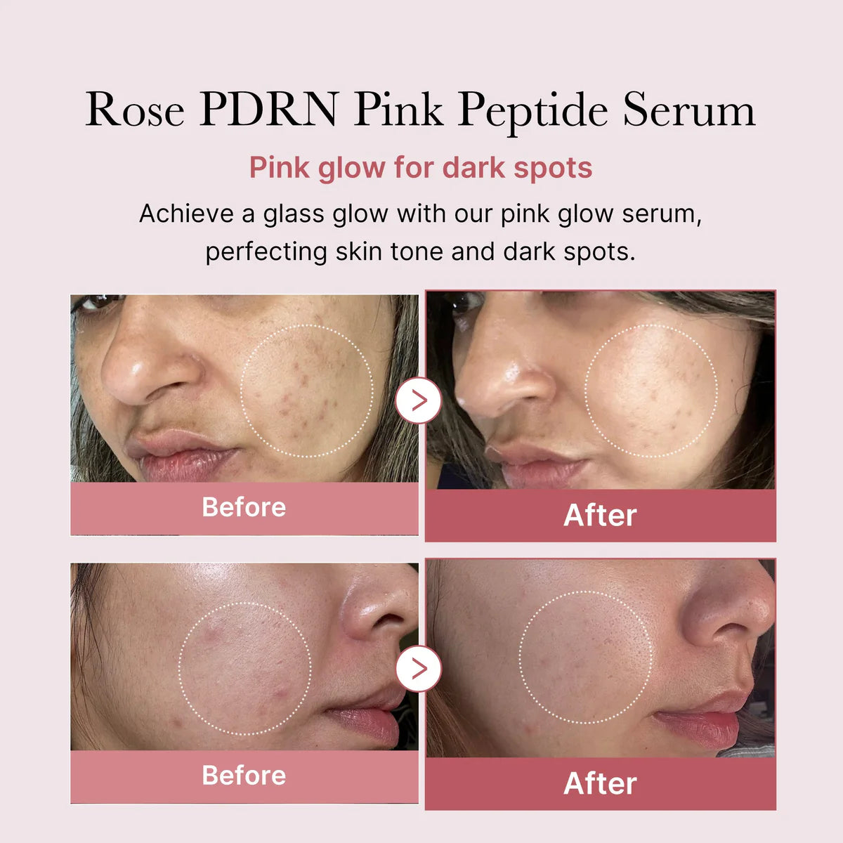 Medicube – PDRN Pink Peptide Serum 30ml
