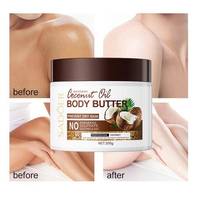 SADOER Coconut Oil Body Butter 200g – Deep Moisturizing Cream with Vitamin E for Dry Skin