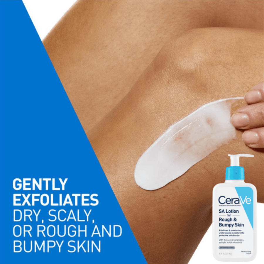 CeraVe SA Lotion 237ml – Salicylic Acid for Rough & Bumpy Skin