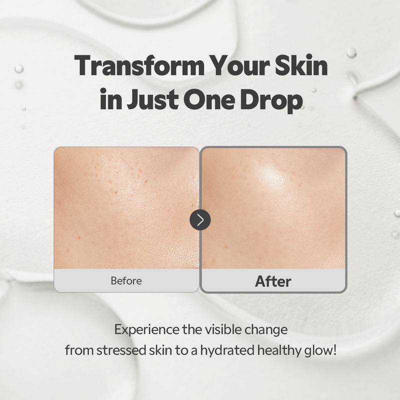 TIRTIR SOS Serum – Korean Hydrating Face Serum for Glass Skin 50ml