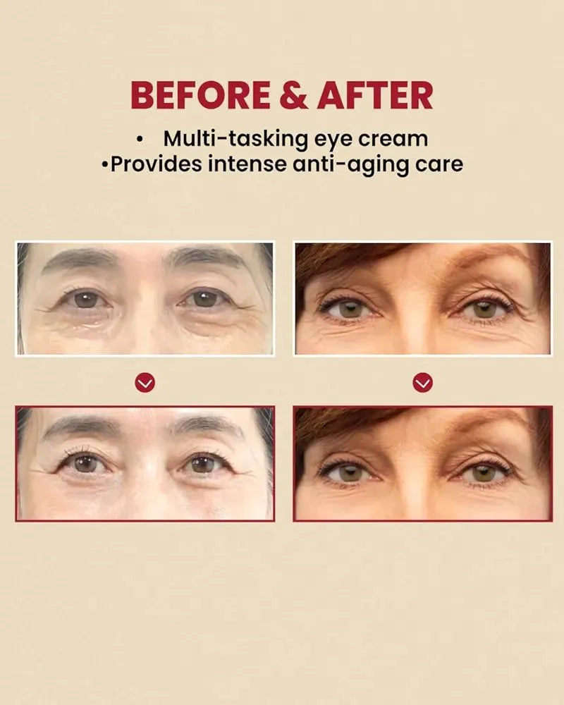 K-SECRET Seoul 1988 Eye Cream – Retinal 4% Korean Anti-Aging