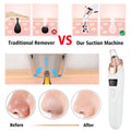 5-in-1 Electric Blackhead Remover Vacuum with LCD Screen