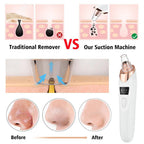 5-in-1 Electric Blackhead Remover Vacuum with LCD Screen