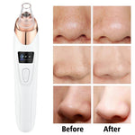 5-in-1 Electric Blackhead Remover Vacuum with LCD Screen