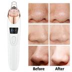 5-in-1 Electric Blackhead Remover Vacuum with LCD Screen