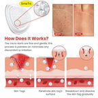 DermaSmooth Skin Tag Remover Patch – Fast & Easy Skin Tag Removal