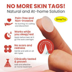 DermaSmooth Skin Tag Remover Patch – Fast & Easy Skin Tag Removal
