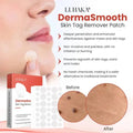 DermaSmooth Skin Tag Remover Patch – Fast & Easy Skin Tag Removal