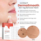 DermaSmooth Skin Tag Remover Patch – Fast & Easy Skin Tag Removal