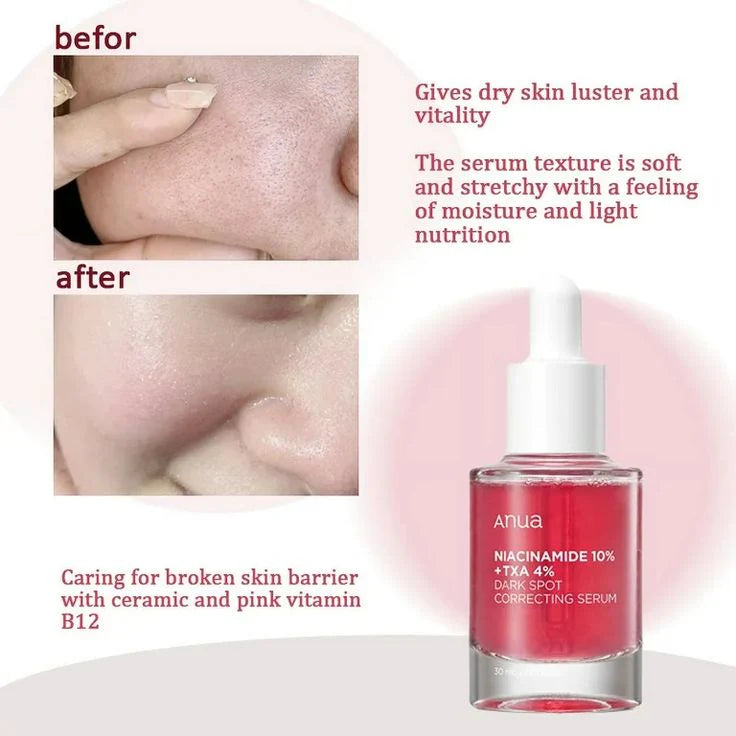 ANUA Niacinamide 10% + TXA 4% Dark Spot Correcting Serum (30ml).