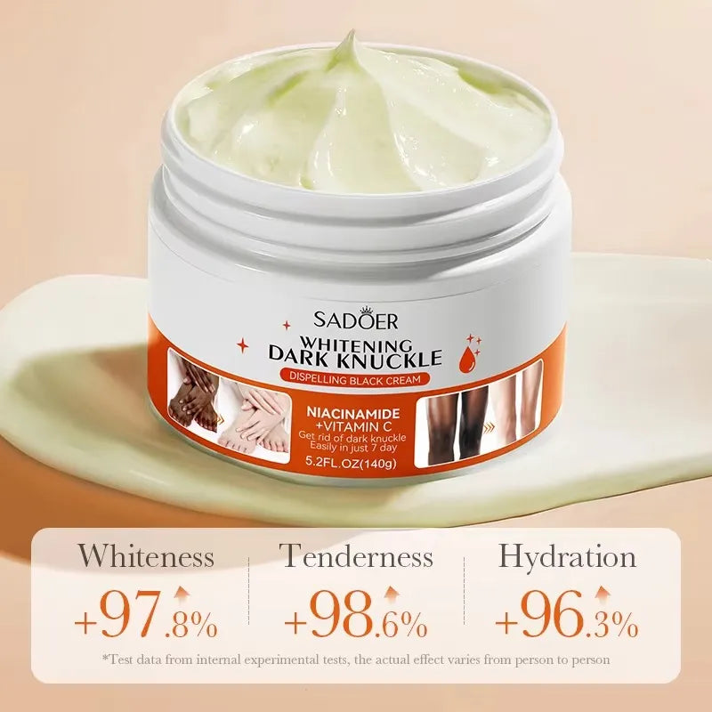 SADOER Dark Knuckle Cream – Whitening Niacinamide Cream for Dark Knuckles & Joints
