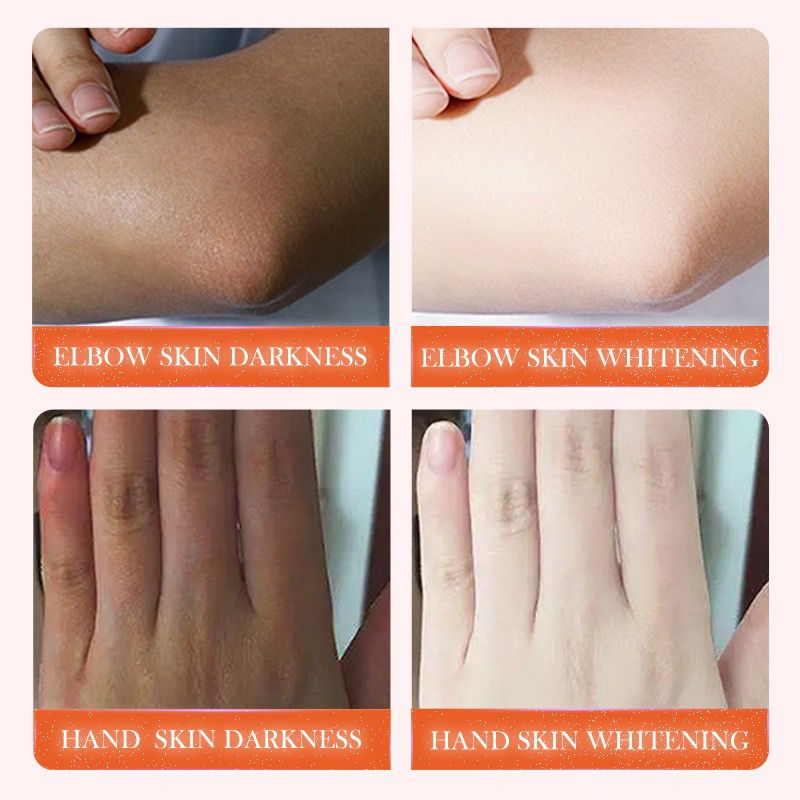 SADOER Dark Knuckle Whitening Serum 50ml | Niacinamide & Vitamin C