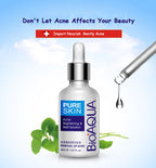 BIOAQUA Acne Rejuvenation Serum 30ml | Clear Skin Care
