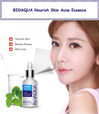 BIOAQUA Acne Rejuvenation Serum 30ml | Clear Skin Care