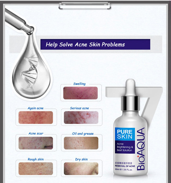 BIOAQUA Acne Rejuvenation Serum 30ml | Clear Skin Care