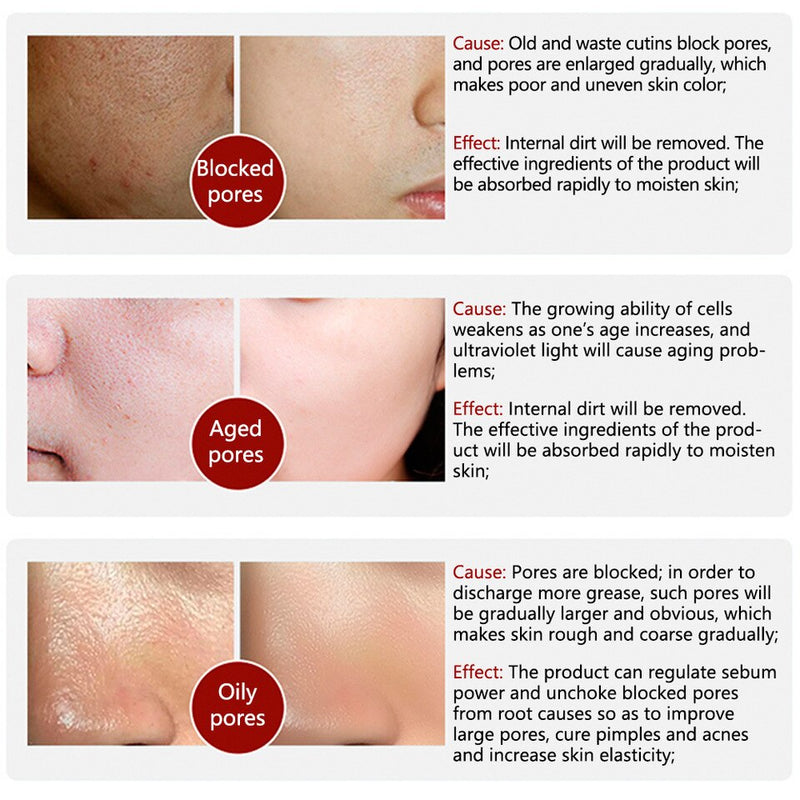HČHANA ROREC Rice Face Serum for Bright & Glowing Skin